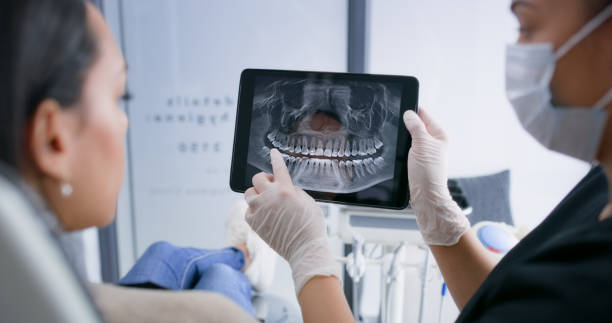Licensed Teeth Whitening service in Ingram, TX - Smile Center Dentistry